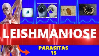 LEISHMANIOSE VISCERAL E LEISHMANIOSE TEGUMENTAR LEISHMANIA SSP  PARASITOLOGIA INFECTOLOGIA [upl. by Tuorah]