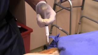 Live Intraarticular Hip Injection with a Hip Replacement [upl. by Ahsircal963]