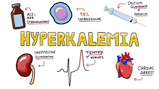 Hyperkalemia  Causes Symptoms Diagnosis and Treatment in Less Than 5 Minutes [upl. by Joellen15]