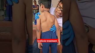 Scoliosis treatment drrajneeshkant worldfamouschiropractor [upl. by Lorien]