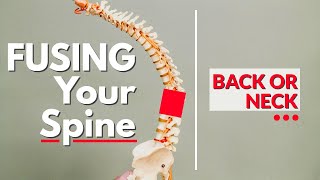 The Problem with Fusing Your Spine Back or Neck [upl. by Ymiaj]