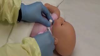 Tracheostomy Tube Change [upl. by Assereht]