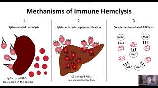 Autoimmune Hemolytic Anemia [upl. by Eirelam]