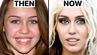 What Happened to Miley Cyrus Face  Plastic Surgery Analysis [upl. by Sigfrid]