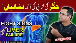 Jigar ki kharabi ki alamat  8 signs of Liver failure [upl. by Nolyat]