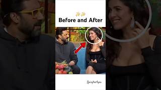 Nimrat kaur Before amp after lip filler💋 shorts ytshortsyoutubeshorts abhishekbachchan nimratkaur [upl. by Oderfla]