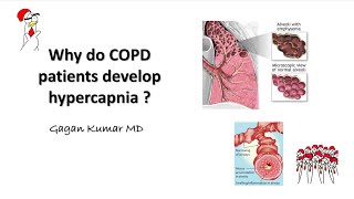 Why does COPD cause hypercapnia [upl. by Ros]