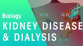 Kidney Disease and Dialysis  Health  Biology  FuseSchool [upl. by Utica]