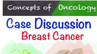 Breast cancer  Case discussion [upl. by Vernice]