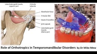 Orthotropics Treatment of Temporomandibular Joint Disorders by Dr Mike Mew [upl. by Royall]