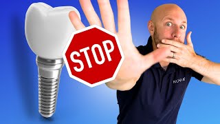 Dont Get Dental Implants WITHOUT Knowing These 5 Things [upl. by Relyt335]