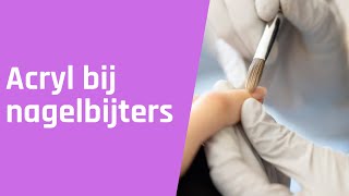 Hoe zet je als nagelstylist acryl op een nagelbijter [upl. by Joby]