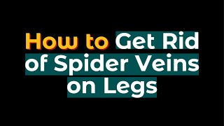 How Doctors Get Rid of Spider Veins [upl. by Dahraf850]