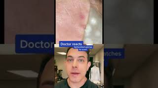 Do hydrocolloid patches work Dermatologist answers  208SkinDoc [upl. by Eelanna621]