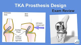 TKA Prosthesis Design Exam Review  Michael Bolognesi MD [upl. by Ozen]