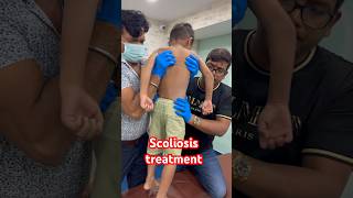 Scoliosis treatment drrajneeshkant [upl. by Kucik]