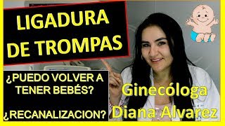 LIGADURA DE TROMPAS ¿PUEDO VOLVER A EMBARAZARME POR GINECOLOGA DIANA ALVAREZ [upl. by Emmeline]