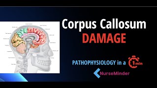 Pathophysiology for Nursing Corpus Callosum and the Nervous System [upl. by Eznyl]