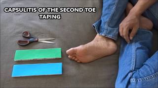 Capsulitis of the second toe taping [upl. by Ltihcox]