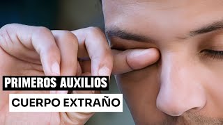 Cuerpo extraño dentro del ojo Primeros auxilios  ¿Que debo hacer [upl. by Vinay]