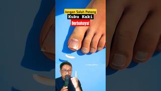 Jangan Salah Potong Kuku Kaki Berbahaya shorts education science nails [upl. by Elly]