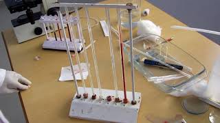 Erythrocyte sedimentation rate [upl. by Trisha]