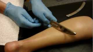 Graston Technique Treatment for Achilles Tendon Injury  Dr Jon Wilhelm Sports Chiropractor [upl. by Dryden902]