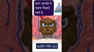 Fissure Treatment  fissure treatment in hindi  fissure treatment at home hindi shorts ytshorts [upl. by Natrav]