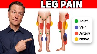 The 11 Causes of Leg Pain Revealed [upl. by Ody]