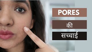 The bitter truth about large pores oily acne skin चेहरे के बड़े छिद्रों को खत्म कर सकते हैं [upl. by Schumer]