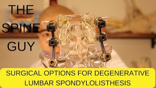 Surgical Options for Degenerative Lumbar Spondylolisthesis  Part 3 [upl. by Shantee]