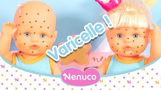 Nenuco Mon Premier Rhume atil la varicelle 🔴 Il faut soigner les bébés avec la malette de docteur [upl. by Notyep304]