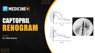 Captopril Renogram Medicine  Dr Dilip Kumar [upl. by Eizus]