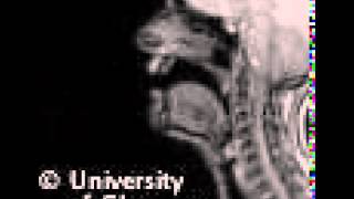 MRI voiceless alveolar lateralfricative [upl. by Baron586]