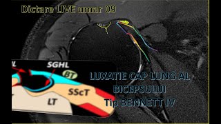 dictare live umar 09 ro [upl. by Bomke]