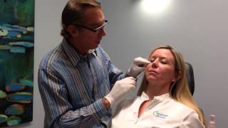 Belllafill Volumization of the Cheeks Pre Jowl Sulcus Jawline Steve Weiner MD [upl. by Creamer]