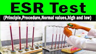 Erythrocyte sedimentation rate  ESR PrincipleProcedureNormal valueshigh and low [upl. by Ahcrop]