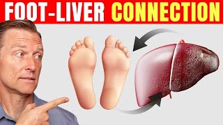 How to Use Your Feet to Diagnose Liver Problems—Dr Berg Explains [upl. by Bekki]