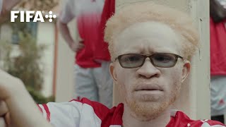 Kenya’s team championing players with albinism  Africa Stories [upl. by Alenairam964]