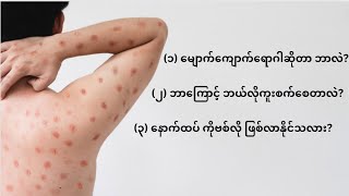 အရေးပေါ်မျောက်ကျောက်ရောဂါ  All You Need to Know about Mpox [upl. by Aracat]