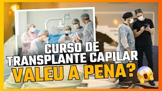 Veja o que os médicos falaram do curso de transplante capilar [upl. by Gerti954]