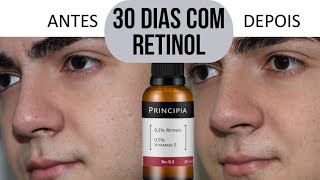 30 DIAS Retinol PRINCIPIA  ANTES E DEPOIS  Skincare [upl. by Lema164]