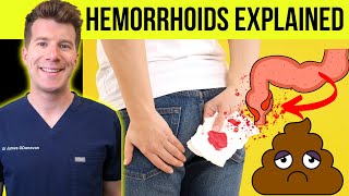 Doctor explains HEMORRHOIDS aka piles  Causes symptoms treatment amp prevention [upl. by Notyard]