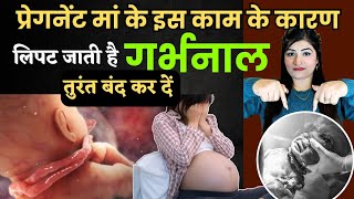 मां के इस काम के कारण लिपट जाती है बच्चे के गले में गर्भनाल  Umbilical Cord Around Baby Neck [upl. by Silsby]