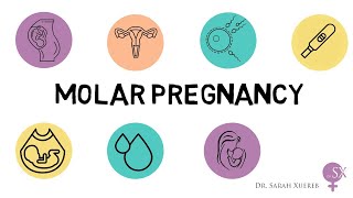 Molar Pregnancy [upl. by Akeihsal]