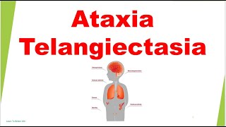 Ataxia Telangiectasia  Immunology USMLE Step 1 [upl. by Droffilc313]