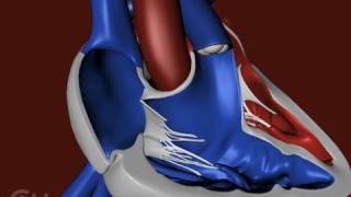 The Structure of a Heart with Tetralogy of Fallot TOF  The Childrens Hospital of Philadelphia [upl. by Sadinoel]