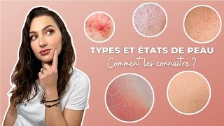 Comment connaître son type  état de peau  Diagnostic conseils et astuces [upl. by Cirad]