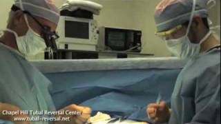 Tubal Reversal Video [upl. by Jedd]