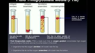 Basics of Fluid Thioglycollate Media FTM  With Examples [upl. by Alletnahs]